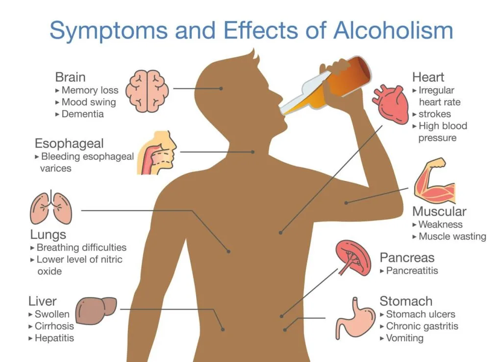 Illustration about health problem of people with alcohol addiction.