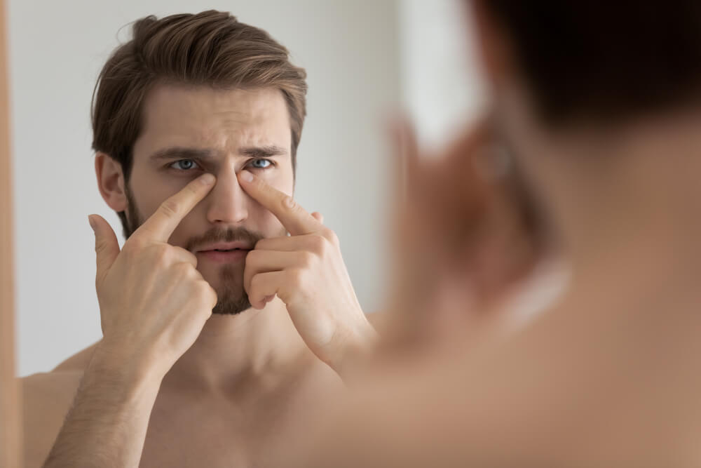 unhappy young man touching under eyes area or facial skin